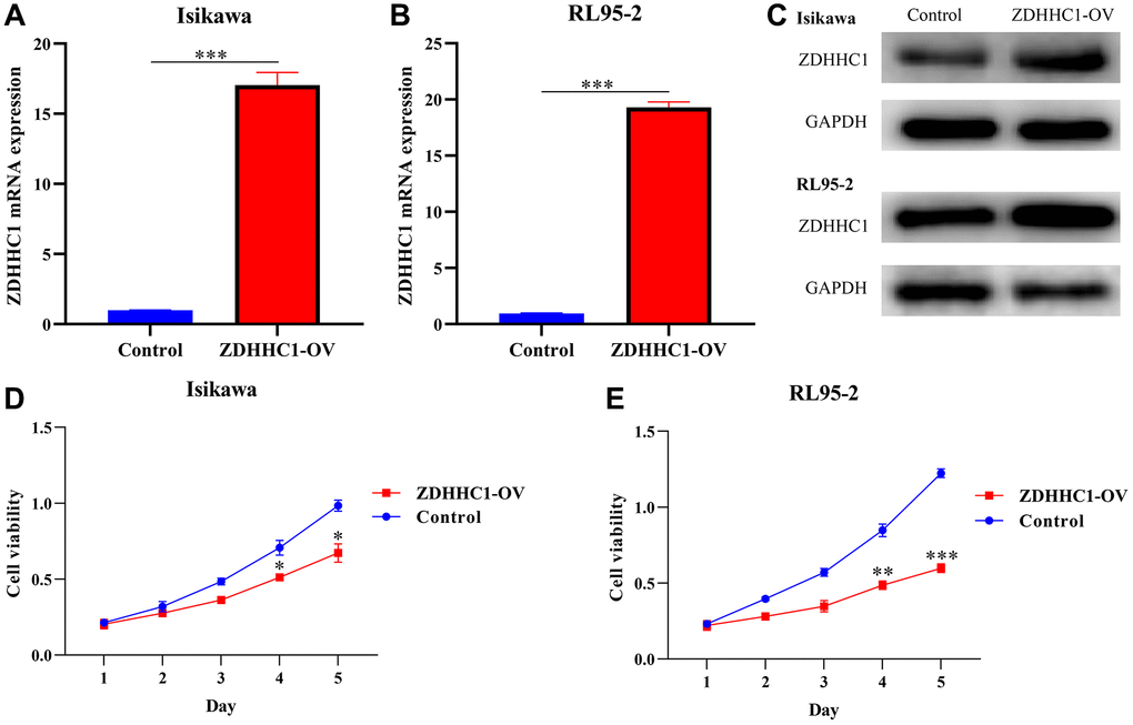 ZDHHC1 overexpression prevents UCEC cell proliferation. (A–C) ZDHHC1 is overexpressed in UCEC cells. (D, E) Cell proliferation assessed with CCK-8 assay. Abbreviations: UCEC: uterine corpus endometrial carcinoma; ZDHHC1: zinc finger DHHC-type containing 1; CCK-8: Cell counting kit-8.