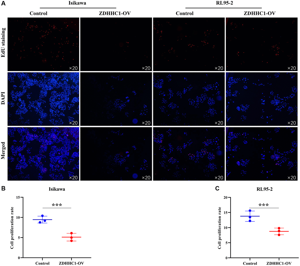 ZDHHC1 overexpression prevents UCEC cell proliferation. (A) Cell proliferation using EdU assay; (B, C) The ability of cell proliferation was analyzed statistically. Abbreviations: UCEC: uterine corpus endometrial carcinoma; ZDHHC1: zinc finger DHHC-type containing 1.