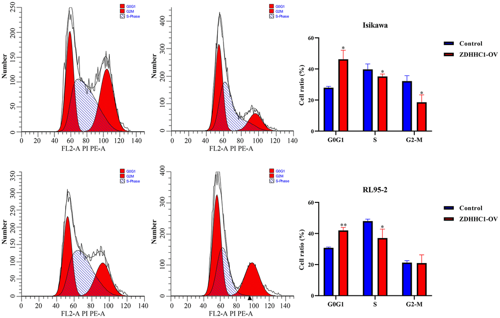 ZDHHC1 overexpression suppresses the cell cycle in UCEC. Abbreviations: UCEC: uterine corpus endometrial carcinoma; ZDHHC1: zinc finger DHHC-type containing 1.