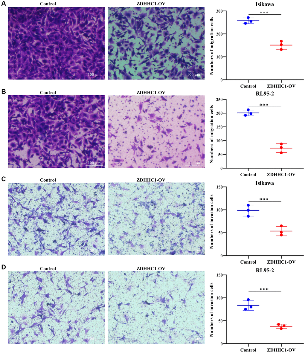 ZDHHC1 overexpression hinders migration and invasion of UCEC cells. (A, B) Cell migration; (C, D) Cell invasion. Abbreviations: UCEC: uterine corpus endometrial carcinoma; ZDHHC1: zinc finger DHHC-type containing 1.