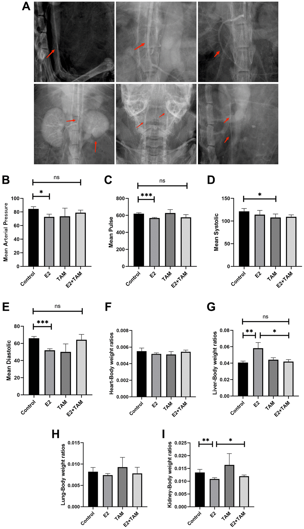 Estrogen-induced inflammatory changes in the aortas of mice. (A) After three months of continuous intraperitoneal injection of E2 in mice, x-ray angiography was performed to observe the condition of the aorta, branches and organs. (B–E) Blood pressure and pulse rate in the tail artery of mice were monitored using a noninvasive sphygmomanometer (n = 6). (F–I) After sacrificing the mice, the hearts, livers, lungs, and kidneys were collected, and the organ/body wet-weight ratios were calculated (n = 6). *P **P ***P 