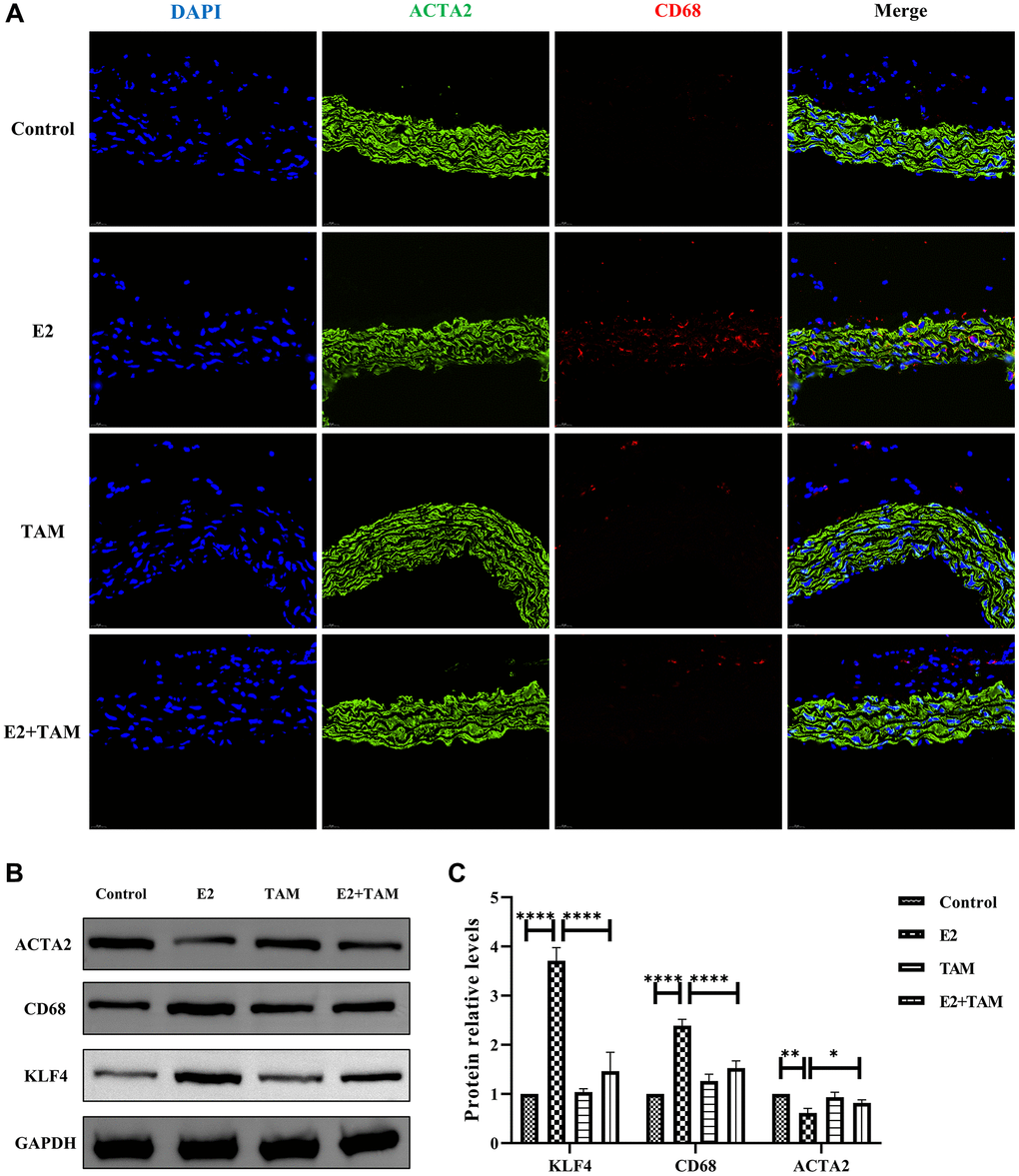 E2 induces transformation of VSMCs into a macrophage-like phenotype in mice and TAM has protective effect on blood vessels. (A) The paraffin sections of abdominal aorta were stained with ACTA2 (green) and CD68 (red). Magnification 630×. (B, C) The whole aortic tissue was lysed, and western blot analysis was performed to analyze the protein levels of KLF4, CD68 and ACTA2 (n = 4). *P **P ****P 