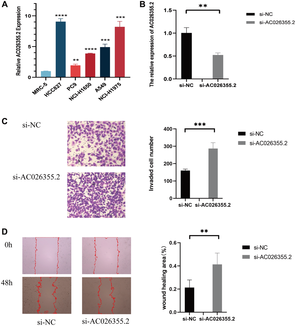 qPCR results showing the expression of AC026355.2 in adenocarcinoma cell lines (A). Relative AC026355.2 expression after siRNA transfection in A549 cells (B). Transwell (C) and scratch (D) assays for cell migration and invasion in A549 cells.