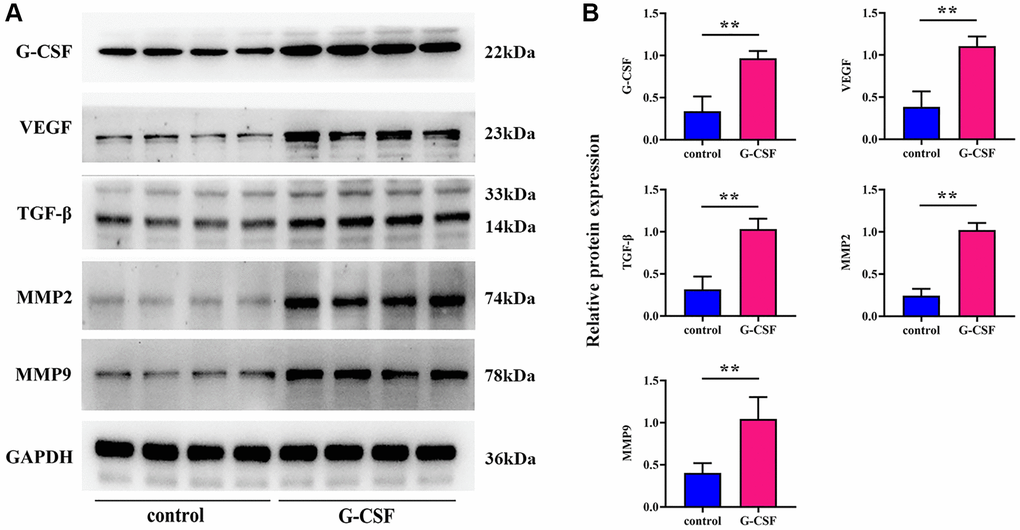 Examination of G-CSF influence on SHP-2 and PI3K/AKT/mTOR pathway activity in neoplastic tissues utilizing western blotting techniques. (A) Protein bands demonstrating SHP-2, phosphorylated PI3K, total PI3K, phosphorylated AKT, total AKT, phosphorylated mTOR, and total mTOR. (B) Comparative proteinic expression levels of SHP-2, the ratio of phosphorylated to total PI3K, the ratio of phosphorylated to total AKT, and the ratio of phosphorylated to total mTOR. The P-value is less than 0.05.
