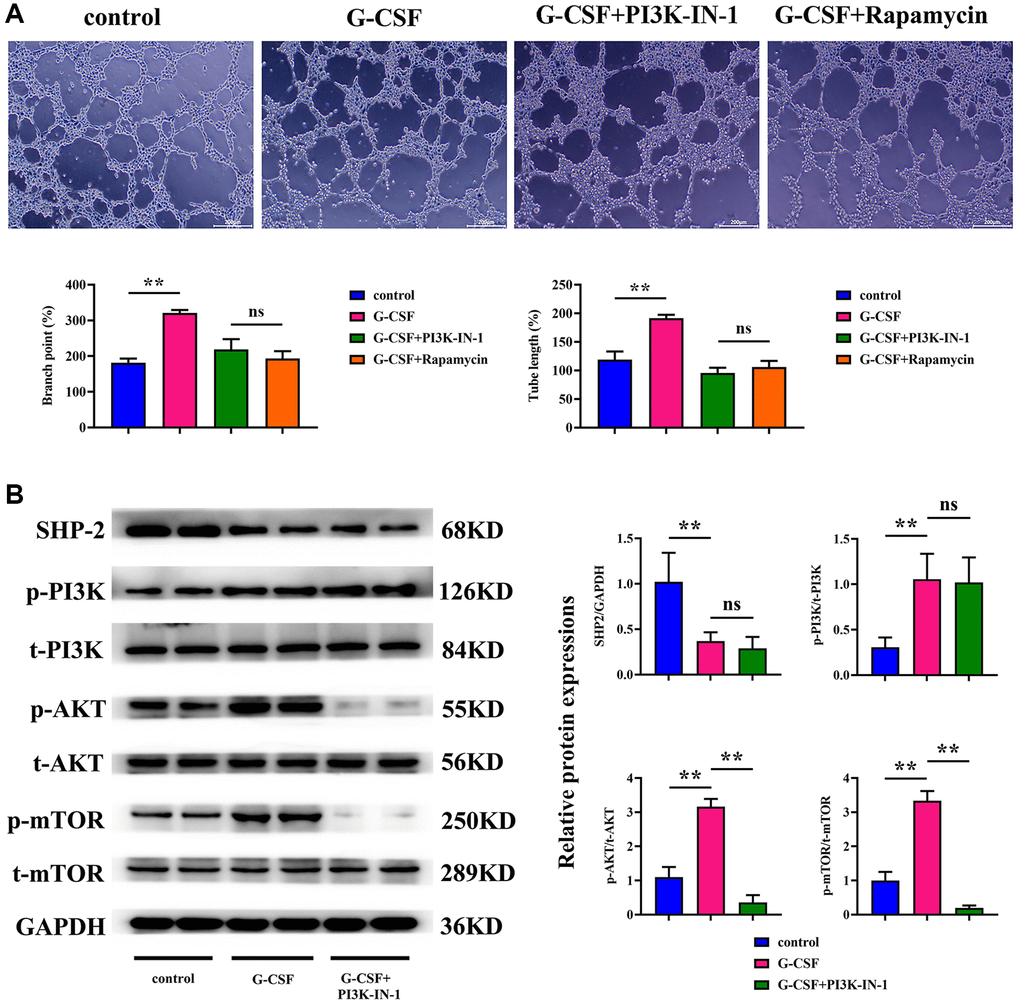 Assessment of the angiogenic potential of SVEC4-10 cells. (A) Conclusions drawn from angiogenesis assays. (B) Statistical enumeration of angiogenic instances. P-value is less than 0.05; P-value is greater than 0.05.