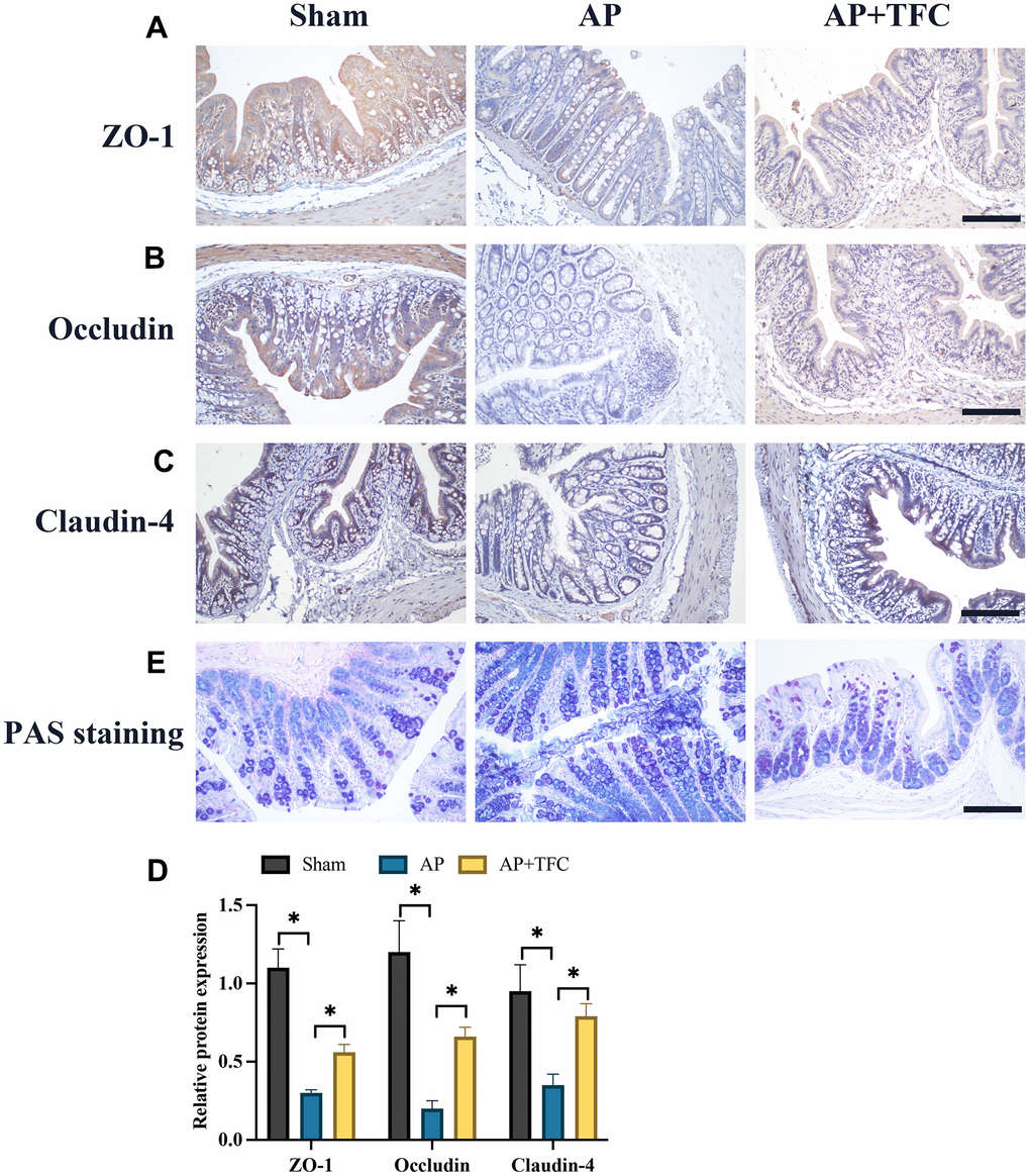 The dysfunction of colonic barrier induced by AP was suppressed by TFC. (A–D) The expression intensity of ZO-1, Occludin, Claudin-4, were measured with IHC staining (Magnification 200X); (E) PAS staining method was performed to detect intestinal mucus in tissues. * indicates p