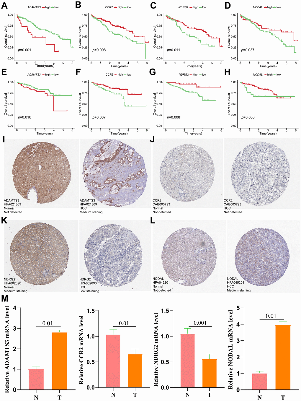 Verification of the prognostic value and expression of hub genes of VPRS. Survival analysis of ADAMTS3, CCR2, NDRG2, and NODAL for patients in TCGA (A–D) and ICGC (E–H) cohorts. The protein expression level of ADAMTS3 (I), CCR2 (J), NDRG2 (K), and NODAL (L) in normal and HCC tissues based on the HPA database. (M) The relative mRNA expression levels of ADAMTS3, CCR2, NDRG2, and NODAL are compared between HCC and non-tumor tissues with real-time PCR results. ***p p p 