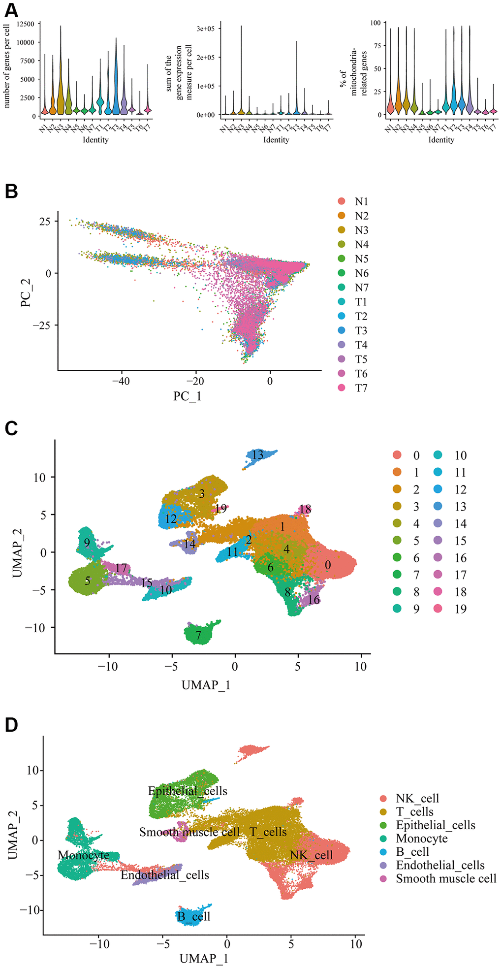 Differential gene expression in prostate cancer in single-cell level. (A) Single cell sequencing analysis using the downloaded dataset showed the number of genes measured per cell, the sum of the gene expression measured per cell, and the percentage of mitochondria-related genes in the prostate cancer in single-cell level. N represented adjacent normal tissues; T represented prostate cancerous tissues. (B) Principal component analysis (PCA) showed the similarity of the samples. (C) Uniform manifold approximation and projection (Umap) classified the single cell into 19 cell clusters. (D) Each cluster was classified into different cell type using SingleR automatic annotation package, including B cell, NK cell, T cell, monocyte, epithelial cells, endothelial cells, and smooth muscle cells.