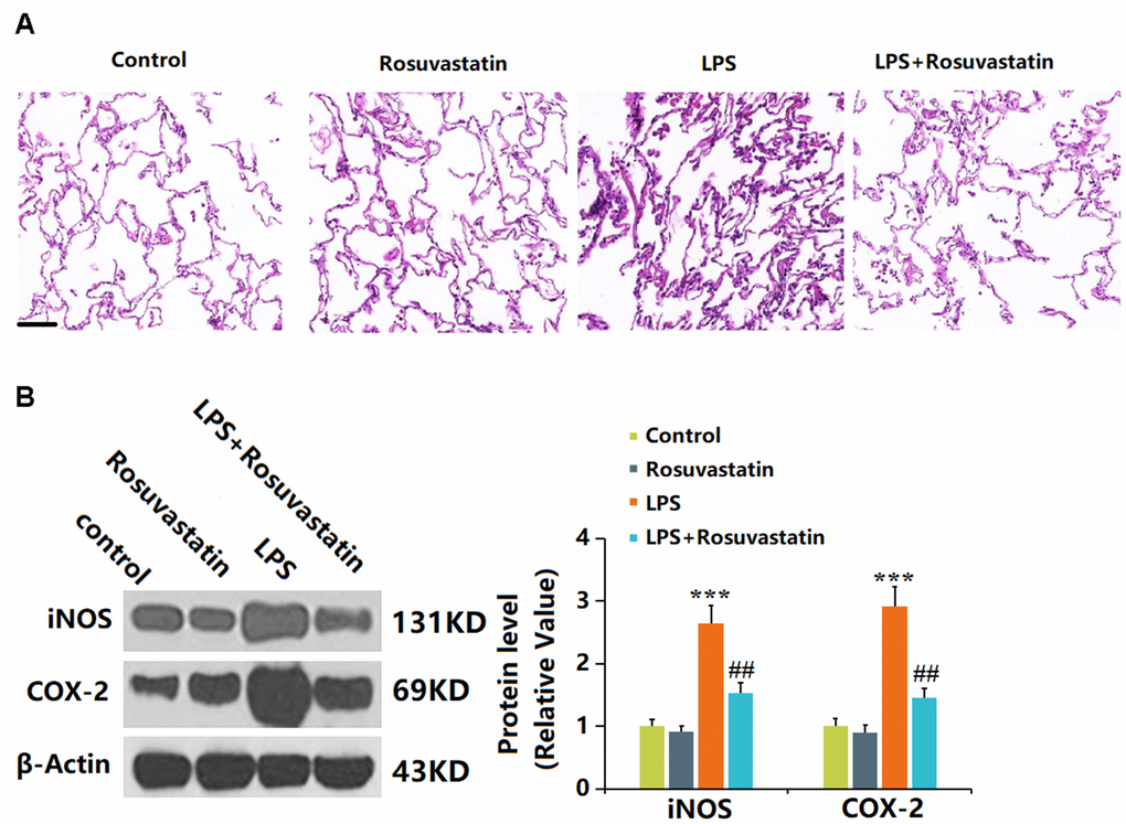 Rosuvastatin reduced lung inflammation in LPS-treated mice. (A) Lung tissues from each treated group were fixed, sectioned, and stained with hematoxylin and eosin (H and E staining); Scale bar, 500 μm; (B) The expression of iNOS and COX-2 proteins in lung tissues was detected using Western blotting (n=8, ***, P