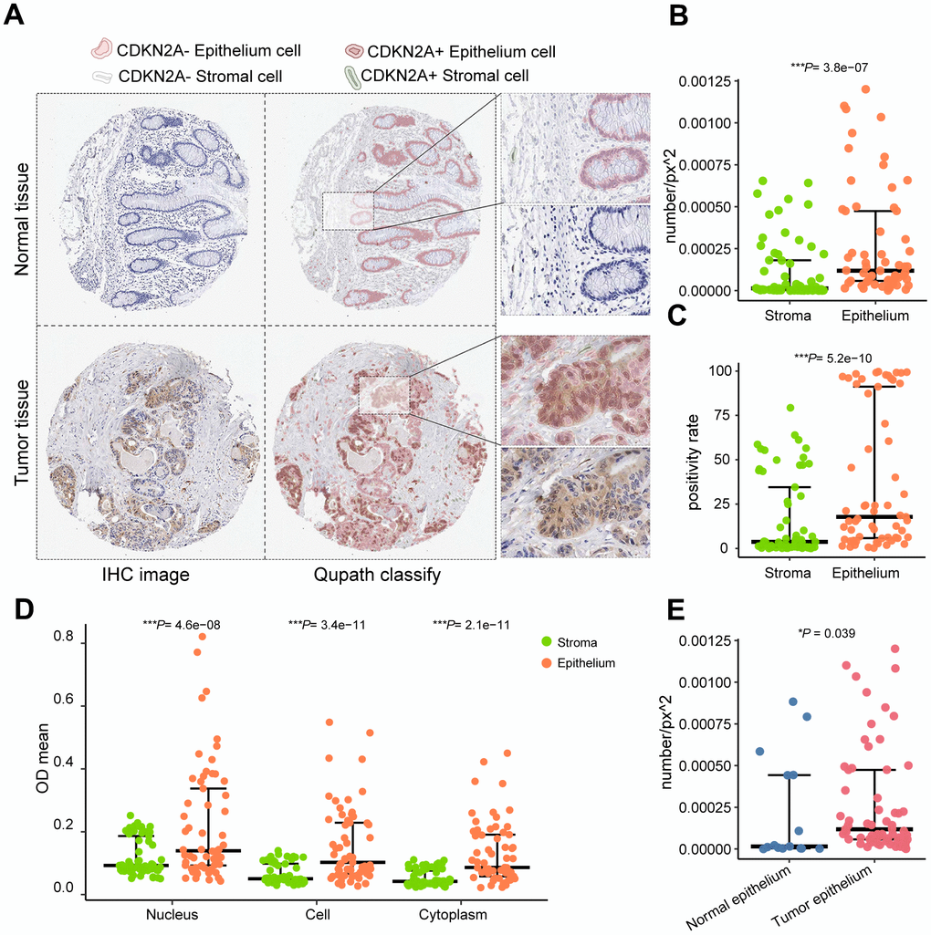 QuPath performs cell identification on immunohistochemical staining images from the Human Protein Atlas. (A) Identified CDKN2A-positive cells and cell types. (B) Comparison of CDKN2A-positive expression density between epithelial tissue and stroma. (C) Comparison of the CDKN2A-positive expression rate between epithelial tissue and stroma. (D) Comparison of CDKN2A-positive staining intensity between epithelial tissue and stroma. (E) Comparison of the positive density of CDKN2A between epithelial tissue in tumor and normal control samples using the Wilcoxon test. ***P 