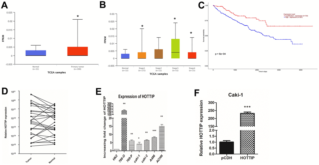 lncRNA-HOTTIP is over-expressed in RCC and associated with a poor prognosis. (A, B) TCGA database of tumor and paracancerous tissue HOTTIP expression; (C) Survival curves of patients with different HOTTIP expression; (D) RT-PCR results showed that lncRNA-HOTTIP expression was significantly up-regulated in RCC tissues; (E) The expression of lncRNA-HOTTIP was detected by RT-PCR, and the results showed that lncRNA-HOTTIP expression was significantly up-regulated in the RCC cell line, and in human normal renal tubular epithelial cells in the control group (*p F) Expression efficiency of lncRNA-HOTTIP lentivirus transfected with Caki-1 was detected by RT-PCR.