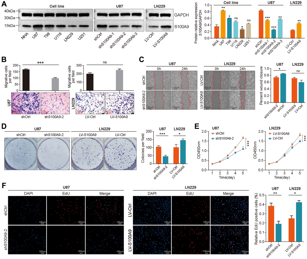 Upregulation of S100A9 promoted the proliferation of GBM cells. (A) Differential expression of S100A9 protein between human astrocyte cells (NHA) and five GBM cell lines. (B, C) Transwell assay (B) and wound healing assay (C) were utilized to detect the migration ability of U87 and LN229 cells transfected with knockout and overexpression S100A9 lentivirus. (D–F) Colony formation assay (D), CCK-8 assay (E), and EdU staining (F) were utilized to detect the proliferative activity of U87 and LN229 cells transfected with knockout and overexpression S100A9 lentivirus.
