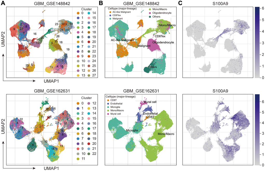 Exploring the expression and distribution of S100A9 in two sets of GBM scRNA-seq data. (A) Cell clusters were identified in GBM cells and displayed in Uniform Manifold Approximation and Projection (UMAP). (B) UMAP plots of different cell types in GBM. (C) Expression and distribution of S100A9 in different types of cells.