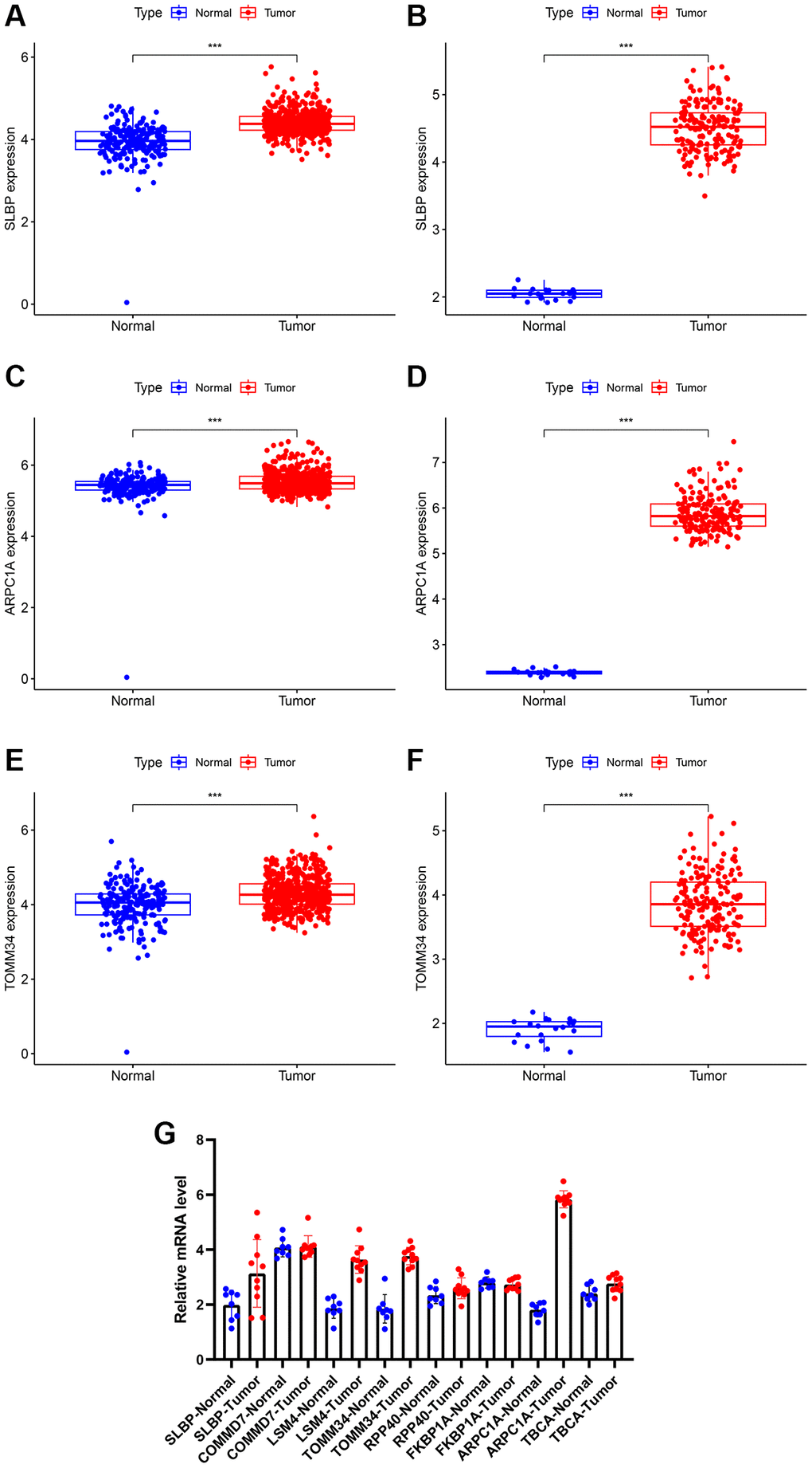 (A, B) Differential expression of analysis of SLBP based on TCGA and CGGA expression. (C, D) Differential expression of analysis of ARPC1A based on TCGA and CGGA expression. (E, F) Differential expression of analysis of TOMM34 based on TCGA and CGGA expression. (G) A higher mRNA expression of ARPC1A was evident in LGG tissues than normal tissue as indicated by the RT-PCR experiments.