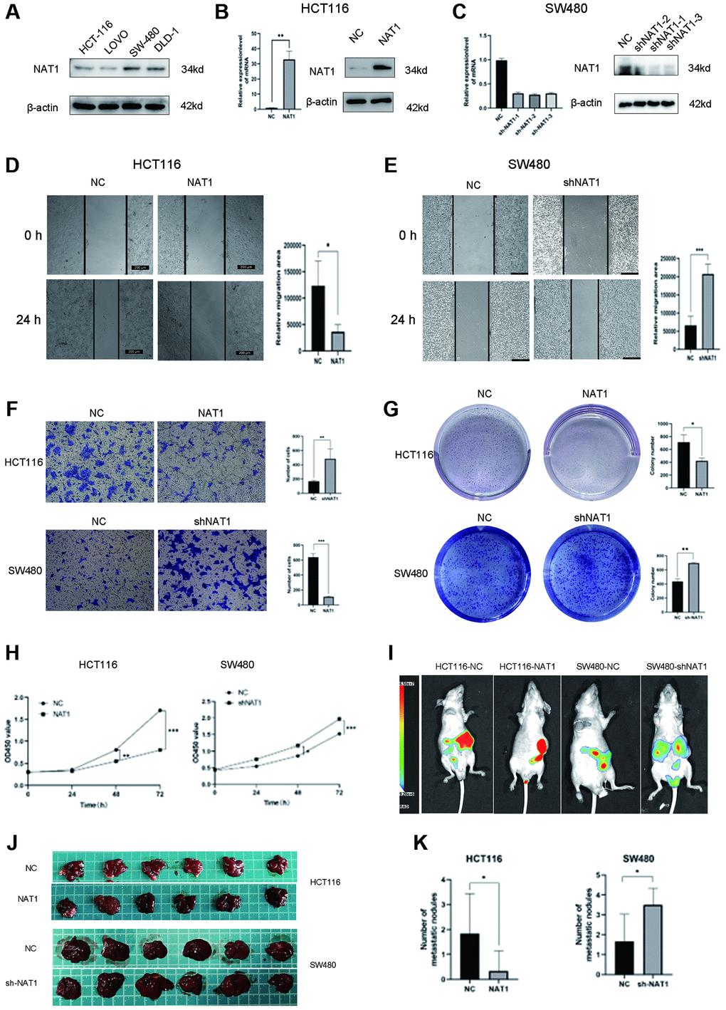 Overexpression of NAT1 inhibits proliferation, migration and liver metastasis of colorectal cancer cells. (A) NAT1 was highly expressed in HCT116 cell line and low expressed in SW480 cell line; (B, C) NAT1 was knocked down in HCT116 cell line and was overexpressed in SW480 cell line; (D, E) Scratch test showed that overexpression of NAT1 could inhibit cell migration ability (P F) Transwell assay showed that overexpression of NAT1 significantly inhibited cell invasion (P G) Plate cloning results showed that high expression of NAT1 had inhibitory effect on cell proliferation (P H) CCK8 assay also confirmed that NAT1 significantly inhibited cell proliferation (P I–K) In vitro animal experiments confirmed that overexpression of NAT1 can inhibit the liver metastasis ability of colorectal cancer cells.