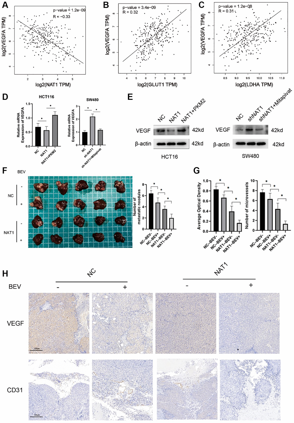 Overexpression of NAT1 weakens the glycolysis ability of colorectal cancer cells and thus inhibits VEGF expression. (A–C) In the TCGA database, VEGFA was negatively correlated with NAT1 expression and positively correlated with the expression of glycolytic related enzymes (GLUT1, LDHA); (D, E) The glycolysis ability of colorectal cancer cells is correlated with the expression of VEGF, and glycolysis can enhance the expression of VEGF; (F) In vitro animal experiments showed that overexpression of NAT1 combined with VEGF inhibitors could better inhibit the occurrence of liver metastasis; (G, H) Overexpression of NAT1 combined with VEGF inhibitors can better reduce the expression of VEGF and CD31 in liver metastases.