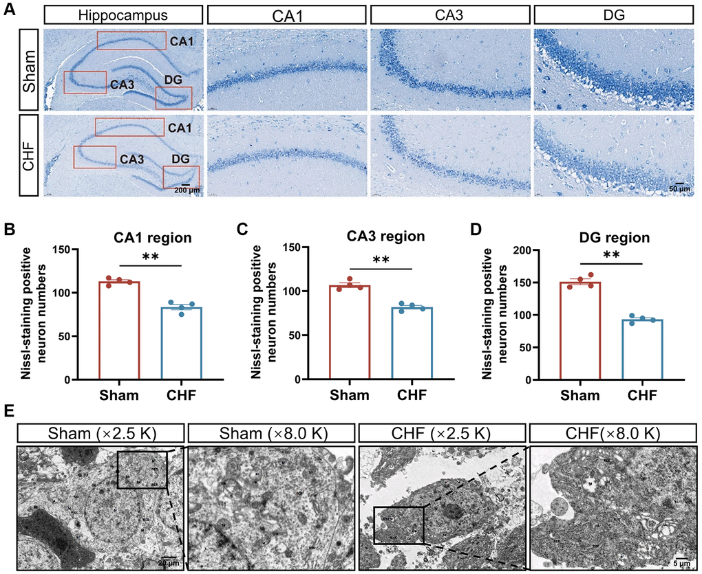 CHF causes the loss of Nissl bodies and ultrastructural damage of neurons in the hippocampus. (A) Representative images of Nissl’s staining. (B–D) Quantifications of Nissl bodies in CA1, CA3, DG regions in the hippocampus, respectively n = 4. (E) Representative ultrastructural images of neurons shown at magnifications of ×2500, scale bars: 20 μm; ×8000, scale bars: 5 μm. Data are presented as the Mean ± SEM; *P **P n = 3.