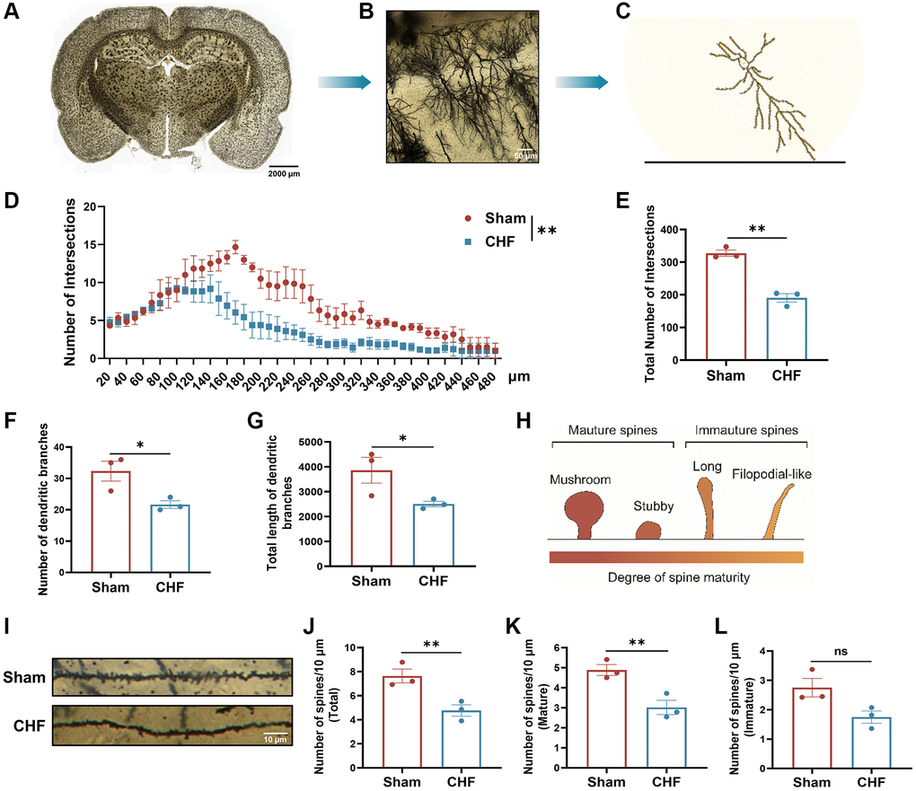 CHF imperils the dendrites and dendritic spines in the hippocampus. (A–C) Examples of reconstructed neurons showing dendritic complexity via Sholl analysis. Scale bars: 50 μm. (D) Dendritic intersection distribution at increasing distance from the cell body. (E–G) Total intersection points (E), dendritic branch numbers (F), and total dendritic branch lengths (G). (H) The classical classifications of spine morphology. (I) Representative examples of dendritic spines. Scale bar: 10 μm. (J–L) Density of dendritic spines, including the number of total spines/10 μm, the number of mature spines/10 μm, the number of immature spines/10 μm. Scale bars: 10 μm. Data are presented as the Mean ± SEM; *P **P n = 3.