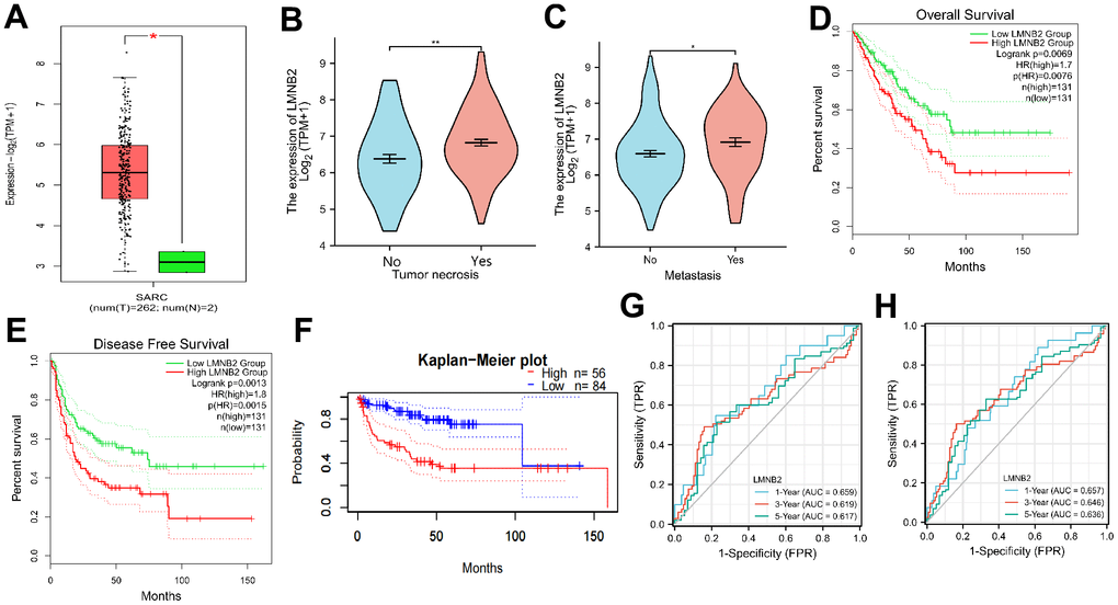 Prognostic relevance of LMNB2 in SARC. (A) Expression levels of LMNB2 in SARC tissues and normal tissues. Red: SARC tissues; Green: normal tissues. (B) Correlation of tumor necrosis and LMNB2 expression level. (C) Correlation of tumor metastasis and LMNB2 expression level. (D) Kaplan–Meier OS analysis of SARC patients with high or low LMNB2 expression, data from TCGA. (E) Kaplan–Meier DFS analysis of SARC patients with high or low LMNB2 expression, data from TCGA. (F) Kaplan–Meier DFS analysis of SARC patients with high or low LMNB2 expression, data from GSE30929. (G) The time dependent ROC analysis of LMNB2 in predicting SARC patients OS rate was showed. (H) The time dependent ROC analysis of LMNB2 in predicting SARC patients DFS rate was demonstrated.