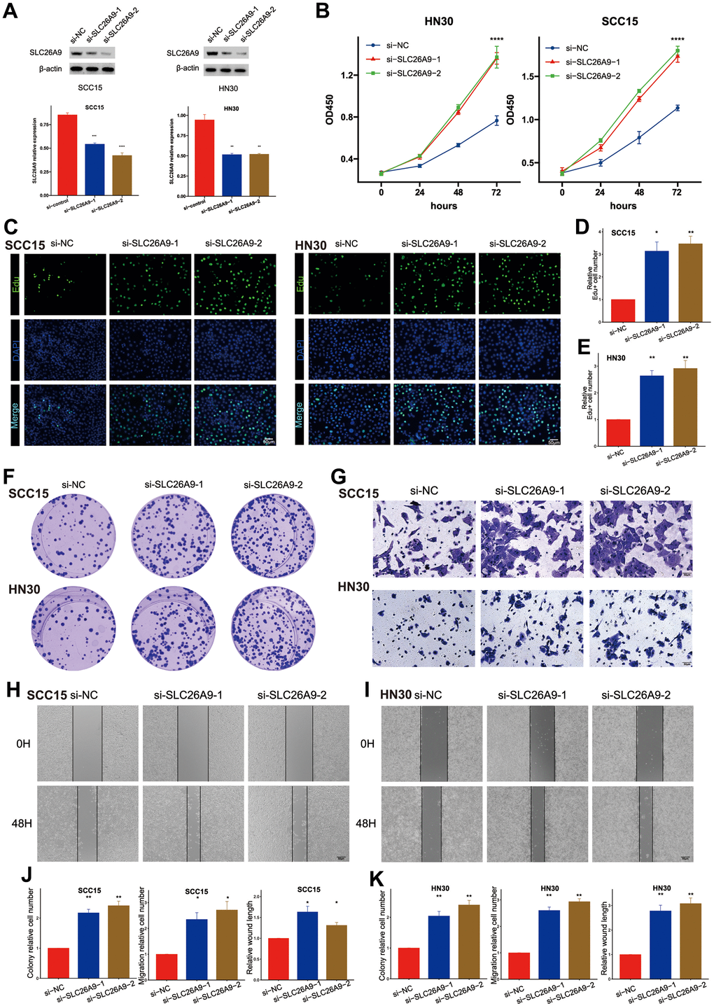 Knockdown of SLC26A9 promoted the proliferation and migration of HNSC cells. (A) SLC26A9 siRNA transfection levels analyzed via Western Blot. (B) CCK8 assay assessing cell viability in SCC15 and HN30 cells with reduced SLC26A9 expression. (C) EdU assay evaluating cell proliferation post SLC26A9 knockdown in SCC15 and HN30 cells. (D, E) Quantitative analysis of EdU-positive cell rates in SCC15 (D) and HN30 (E) cells. (F) Notable reduction in clone numbers in SCC15 and HN30 cells following SLC26A9 knockdown. (G) Transwell assay measuring migration capability of SCC15 and HN30 cells with decreased SLC26A9 expression. (H, I) Cell scratch assay examining proliferation in SCC15 (H) and HN30 (I) cells post SLC26A9 reduction. (J, K) Quantitative summary of clone numbers, migration rates in transwell assay, and wound healing rates in SCC15 (J) and HN30 (K) cells.