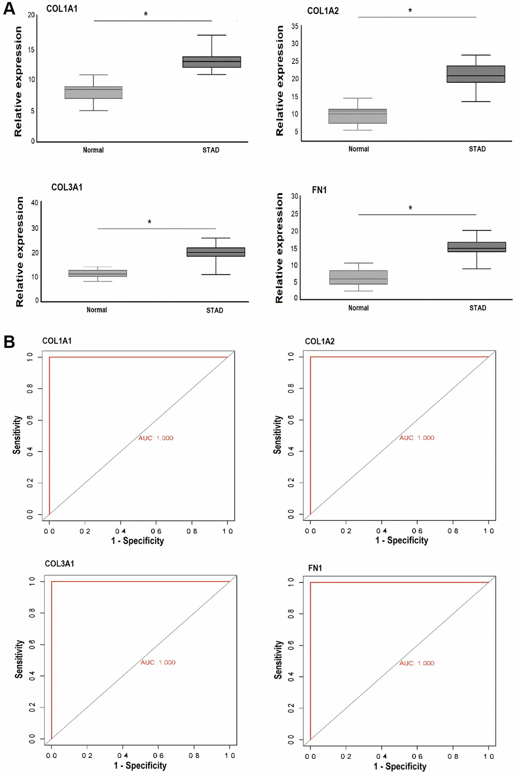 This figure depicts the relative expression and receiver operating characteristic (ROC) curve analysis of COL1A1, COL1A2, COL3A1, and FN1 in Pakistani gastric cancer (GC) patients and normal controls. (A) Presents the relative expression analysis of these genes in Pakistani GC patients and control samples via RT-qPCR. (B) Shows the ROC curves based on RT-qPCR expression of COL1A1, COL1A2, COL3A1, and FN1. A significance level of P P-value 
