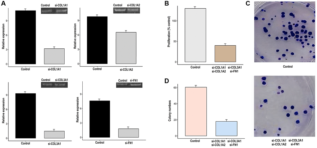 Knockdown of COL1A1, COL1A2, COL3A1, and FN1 impairs the growth and metastatic potential of gastric cancer (GC) cells (AGS). (A) The transfection efficiency of si-COL1A1, si-COL1A2, si-COL3A1, and si-FN1 was checked with the help of RT-qPCR, (B) AGS control and transfected cells were analyzed proliferation, (C, D) Colony formation.