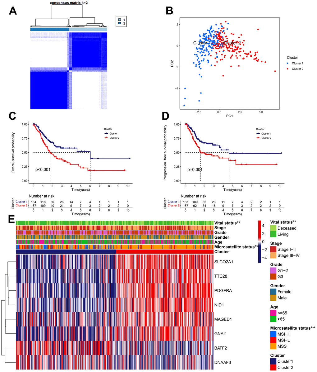Identification of IRG subtypes in GC. (A) Consensus matrix heatmap defining two clusters (k = 2) and their correlation area. (B) A considerable transcriptome divergence between the two subtypes is seen by PCA analysis. (C) The Kaplan–Meier curve of OS analysis between different cluster groups. (D) The Kaplan–Meier curve of PFS analysis between different cluster groups. (E) Differences in clinicopathologic features and expression levels of IRGs between the two subtypes.