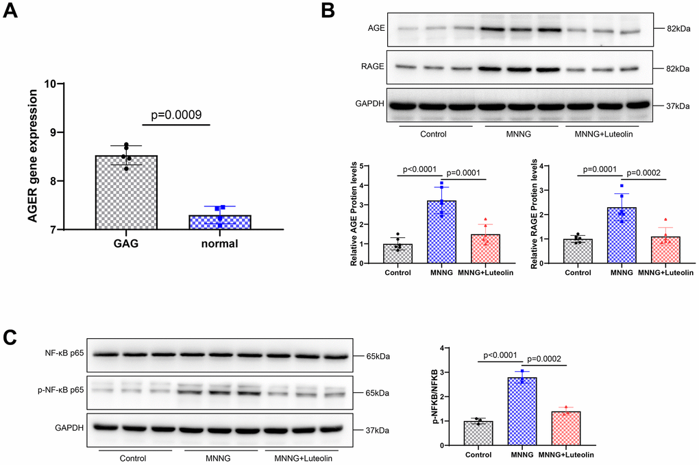 Luteolin inhibits the activity of the AGE-RAGE signaling pathway. (A) RAGE expression in the CAG disease database. (B) Western blot. The protein expression levels of AGE and RAGE were determined. (C) Western blot assay was used to detect the protein expression levels of NF-κB p65 and p-NF-κB p65.