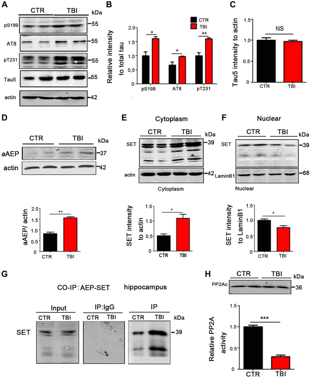 TBI caused tau hyperphosphorylation and cytoplasmic retention of SET accompanied by AEP activation. (A–C) Hippocampal tissues were homogenized, and tau protein levels of pS199, pS202/pT205 (AT8), pT231 were detected by immunoblotting (A, B). Total tau level was measured (C) with actin as loading control. (D) aAEP (molecular weight at 36KD) was measured by immunoblotting. (E, F) We separate cytosolic and nuclear proteins: SET in cytoplasm (E) and in nuclei (F) were measured. (G) The interaction of AEP and SET was evaluated by Co-IP. (H) Hippocampal PP2A level and activity were tested. n = 3. P-value significance is calculated from a one-way ANOVA, data are represented as mean ± SEM. *p **p ***p 