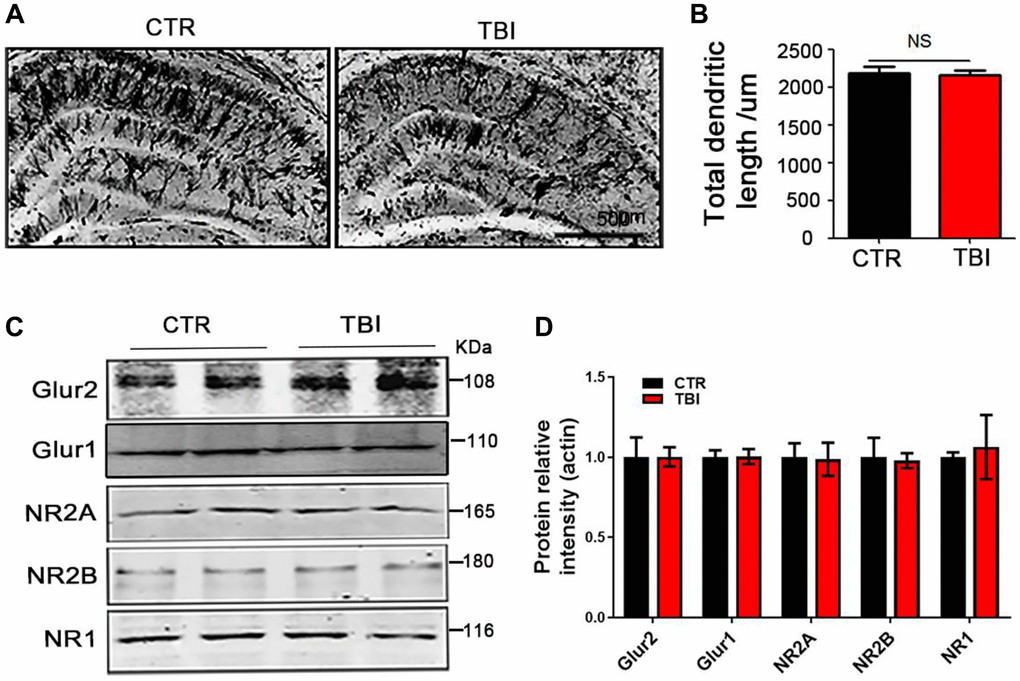 Traumatic brain injury led to synaptic dysfunction. (A) Representative dendritic spines of neurons from Golgi impregnated hippocampus. Scale bar = 500 μm. (B) Total dendritic length. (C, D) Brain tissues from hippocampus were homogenized, and synaptic protein levels were detected by immunoblotting, n = 3. P-value significance is calculated from a one-way ANOVA, all data represent mean ± SEM.