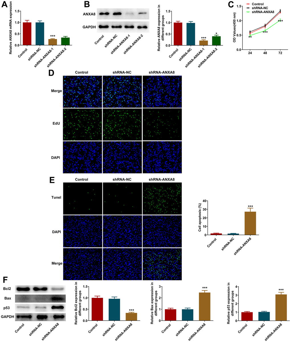 Interference with ANXA8 inhibited the proliferation and promoted the apoptosis of CAOV3 cells. (A) ANXA8 interference plasmid was constructed, and its interference efficacy was detected by RT-qPCR; (B) The transfection efficacy of ANXA8 interference plasmid was detected using western blotting; (C) CCK-8 assay was used to detect cell activity; (D) EdU staining was used to determine cell proliferation; (E) TUNEL staining was used to detect the level of apoptosis; (F) Western blot analysis of the expression of apoptosis-related proteins. *P