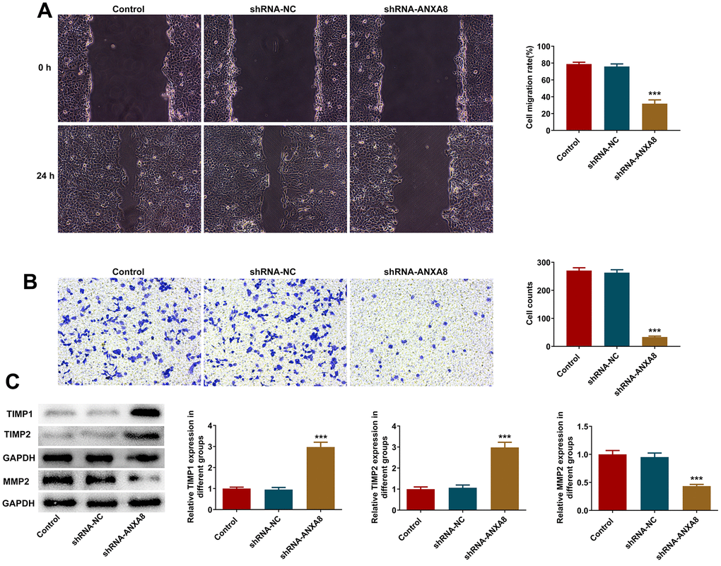 Interference with ANXA8 inhibited the invasion and migration of CAOV3 cells. (A) Wound healing assay was used to detect the migration ability of CAOV3 cells; (B) Transwell assay was used to detect the invasion ability of CAOV3 cells; (C) Western blot analysis of the expression of invasion and migration-related proteins TIMP1, TIMP2, and MMP2 in CAOV3 cells. ***P