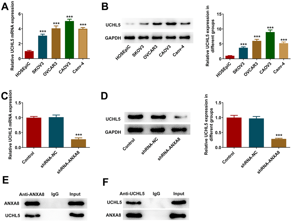 ANXA8 bound to UCHL5 in CAOV3 cells. (A) The expression of UCHL5 in the OC cell line was detected by RT-qPCR; (B) The expression of UCHL5 in the OC cell line was detected by western blotting. ***PC) After interference with ANXA8, the expression of UCHL5 was detected by RT-qPCR; (D) After interference with ANXA8, the expression of UCHL5 was detected using western blotting; (E, F) The binding ability between ANXA8 and UCHL5 was verified by IP experiments. ***P