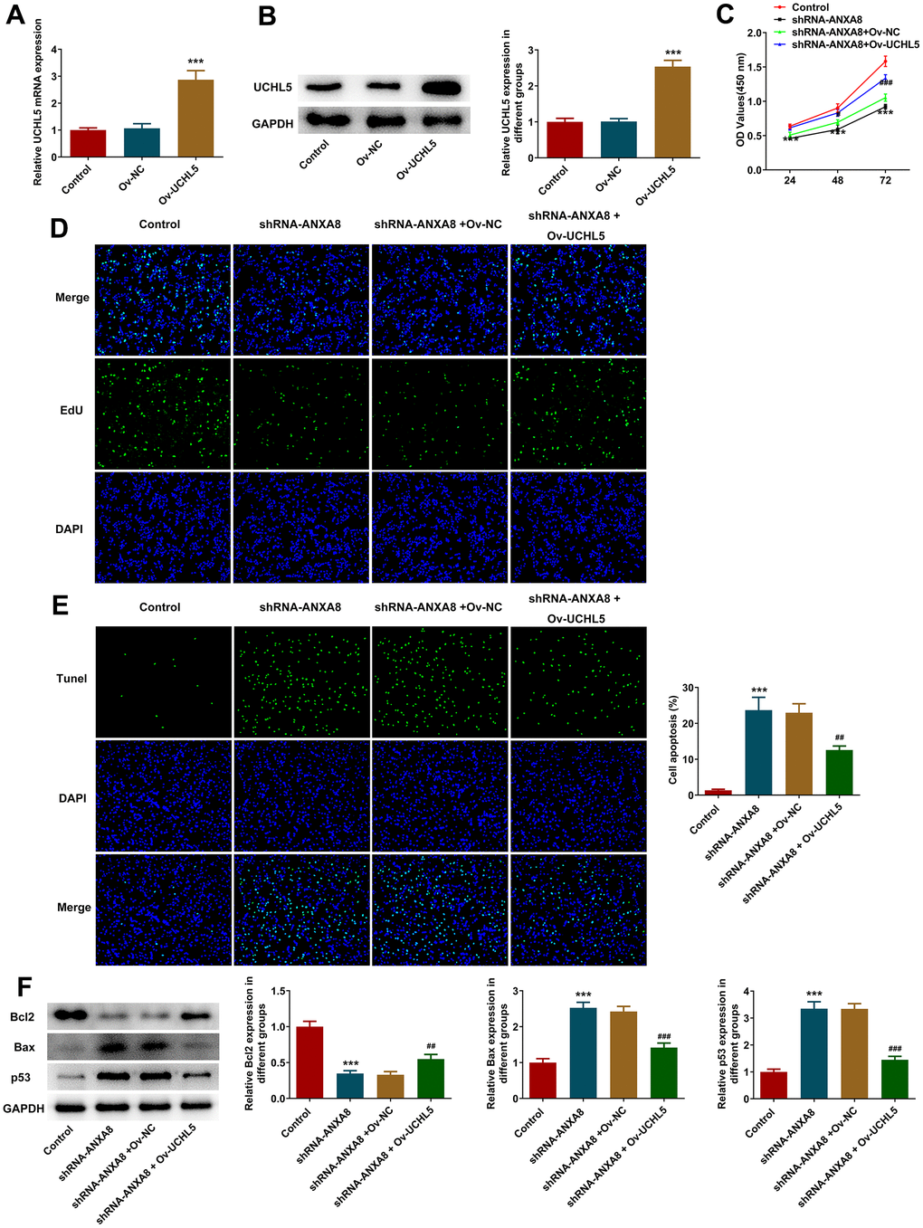 Interference with ANXA8 inhibited the proliferation and promoted the apoptosis of CAOV3 cells through UCHL5. (A) The overexpressed plasmid of UCHL5 was constructed, and its transfection efficiency was detected by RT-qPCR; (B) The overexpressed plasmid of UCHL5 was constructed, and its transfection efficiency was detected by western blotting; ***PC) CCK-8 was used to determine cell activity; (D) EDU staining was used to detect cell proliferation; (E) TUNEL staining was used to detect the level of apoptosis; (F) Western blot analysis of the expression of apoptosis-related proteins. ***P