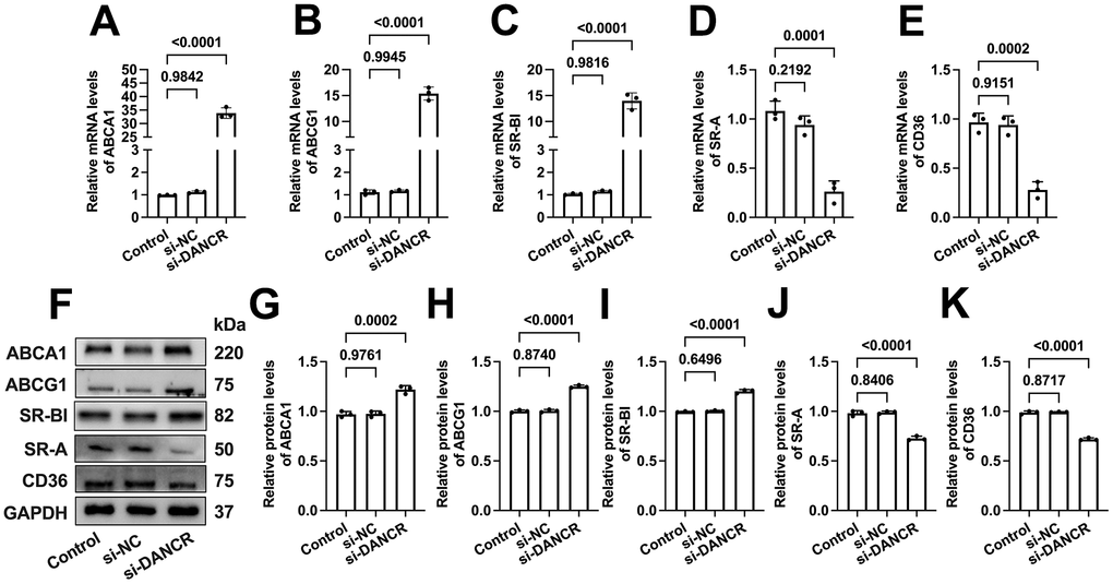 Effects of DANCR inhibition on the expression of membrane cholesterol transporters in ox-LDL-treated THP-1 macrophages. THP-1 macrophages were treated with 50 μg/mL ox-LDL for 24 h. Then, they were transfected with 1×1010 TU/mL LV-DANCR or 20 μM si-DANCR or their corresponding control for 48 h. (A–E) Detection of the mRNA levels of ABCA1, ABCG1, SR-BI, SR-A, and CD36 by qPCR. (F–K) Detection of the protein levels of ABCA1, ABCG1, SR-BI, SR-A, and CD36 by Western blot. All results are presented as the mean ± SD from three independent experiments performed in triplicate. n=3.
