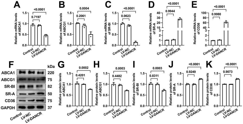 Effects of DANCR overexpression on the expression of membrane cholesterol transporters in ox-LDL-treated THP-1 macrophages. THP-1 monocytes were incubated with 160 ng/mL PMA for 48 h to differentiate into macrophages. Then, they were treated with 50 μg/mL ox-LDL for 24 h, followed by transfection with 1×1010 TU/mL LV-NC or LV-DANCR 48 h. (A–E) Detection of the mRNA levels of ABCA1, ABCG1, SR-BI, SR-A, and CD36 by qPCR. (F–K) Detection of the protein levels of ABCA1, ABCG1, SR-BI, SR-A, and CD36 by Western blot. All results are presented as the mean ± SD from three independent experiments performed in triplicate. n=3.