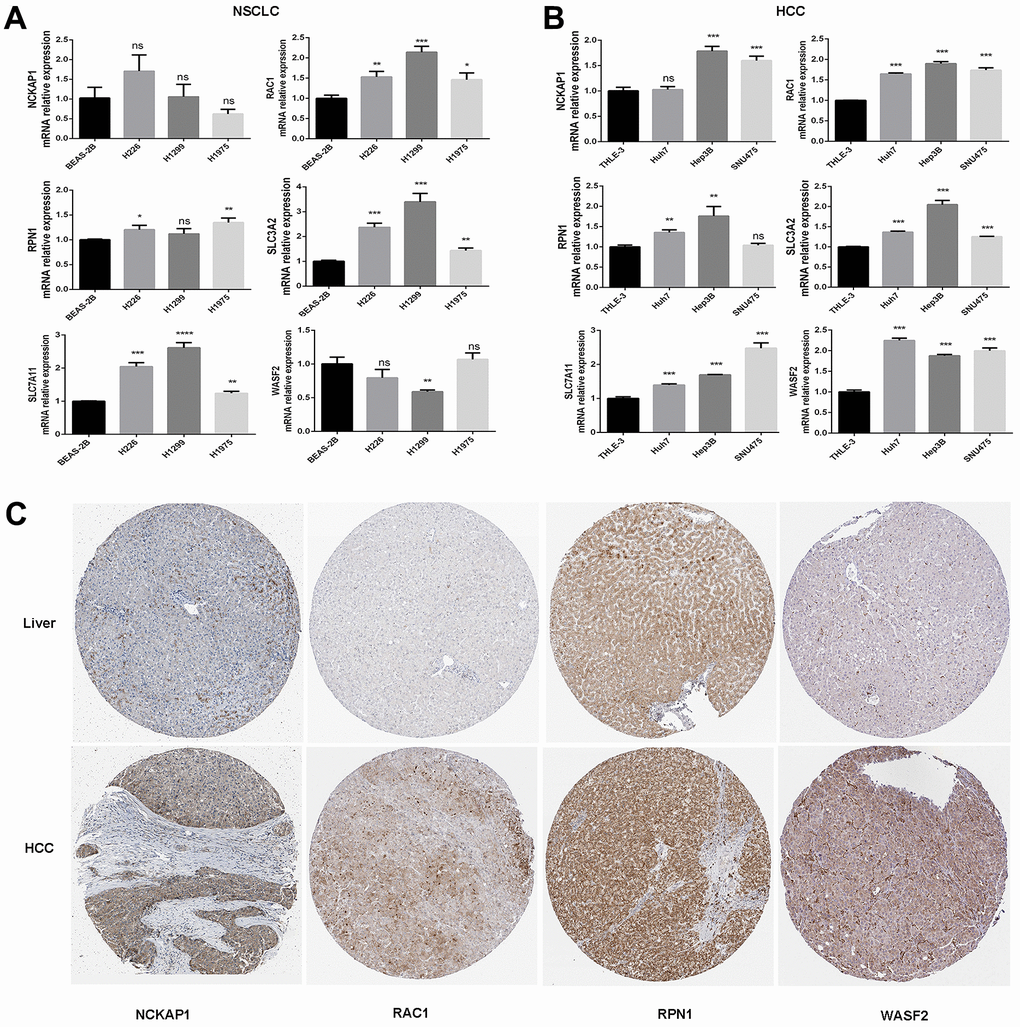 The mRNA expression and protein levels of disulfidptosis genes were detected. (A) The mRNA expression of human normal lung epithelial cells (BEAS-2B), and lung squamous cell carcinoma cell line (H226), and lung adenocarcinoma cell lines (H1299 and H1975) was detected by RT-PCR. (B) The mRNA expression of normal liver epithelial cells (THLE-3) and hepatocellular carcinoma cells (Huh7, Hep3B, and SNU475). (C) Comparison of NCKAP1, RAC1, RPN1, and WASF2 immunohistochemistry images in normal and tumor tissues. NCKAP1, RAC1, RPN1, and WASF2 protein expression were significantly higher in LIHC.