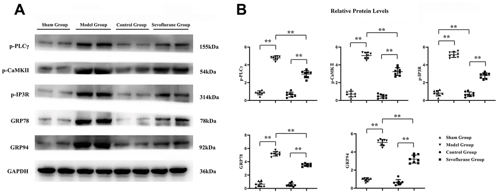 Sevoflurane could relieve calcium influx and ER stress. (A) Protein bands of p-PLCγ, p-CaMKII, p-IP3R, GRP78 and GRP94 in Sham group, Model group and Sevoflurane group, (B) relative protein expressions of p-PLCγ, p-CaMKII, p-IP3R, GRP78 and GRP94 in Sham group, Model group and Sevoflurane group. Sham group vs. Model group, Model group vs. Sevoflurane group, Control group vs. Sevoflurane group, **P