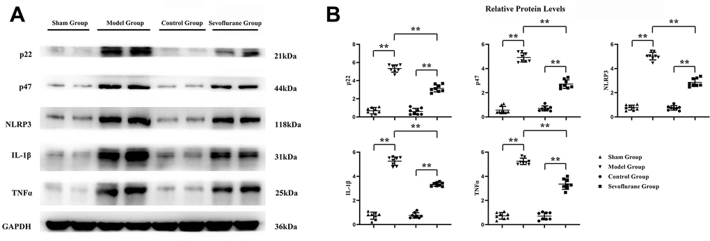 Sevoflurane could reduce oxidative stress and inflammation. (A) Protein bands of P22, P47, NLRP3, IL-1β and TNF-α in Sham group, Model group and Sevoflurane group, (B) relative protein expressions of P22, P47, NLRP3, IL-1β and TNF-α in Sham group, Model group and Sevoflurane group. Sham group vs. Model group, Model group vs. Sevoflurane group, Control group vs. Sevoflurane group, **P