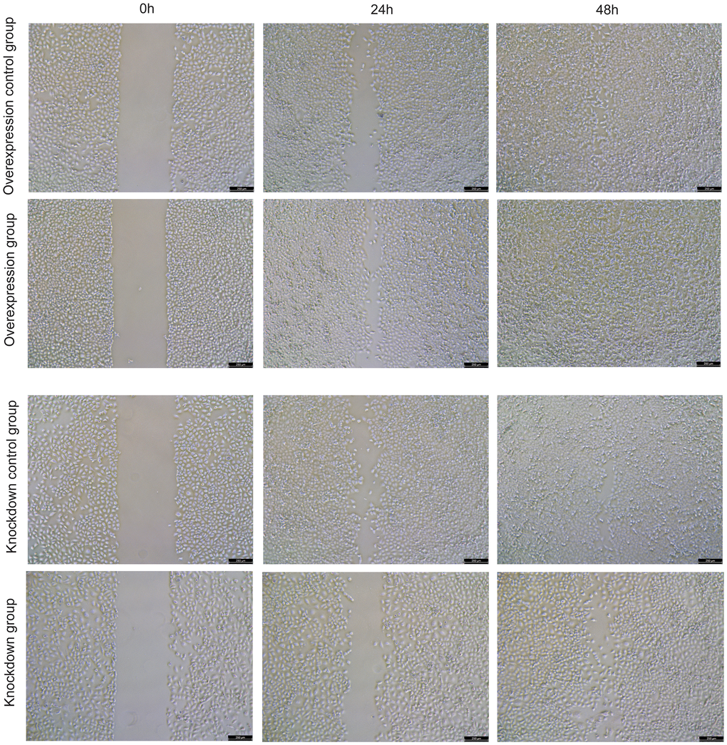 The effect of overexpression and knockdown of HNRNPC on the migration of NCI-H1299 cells was detected by cell scratch assay at 24 h and 48 h.