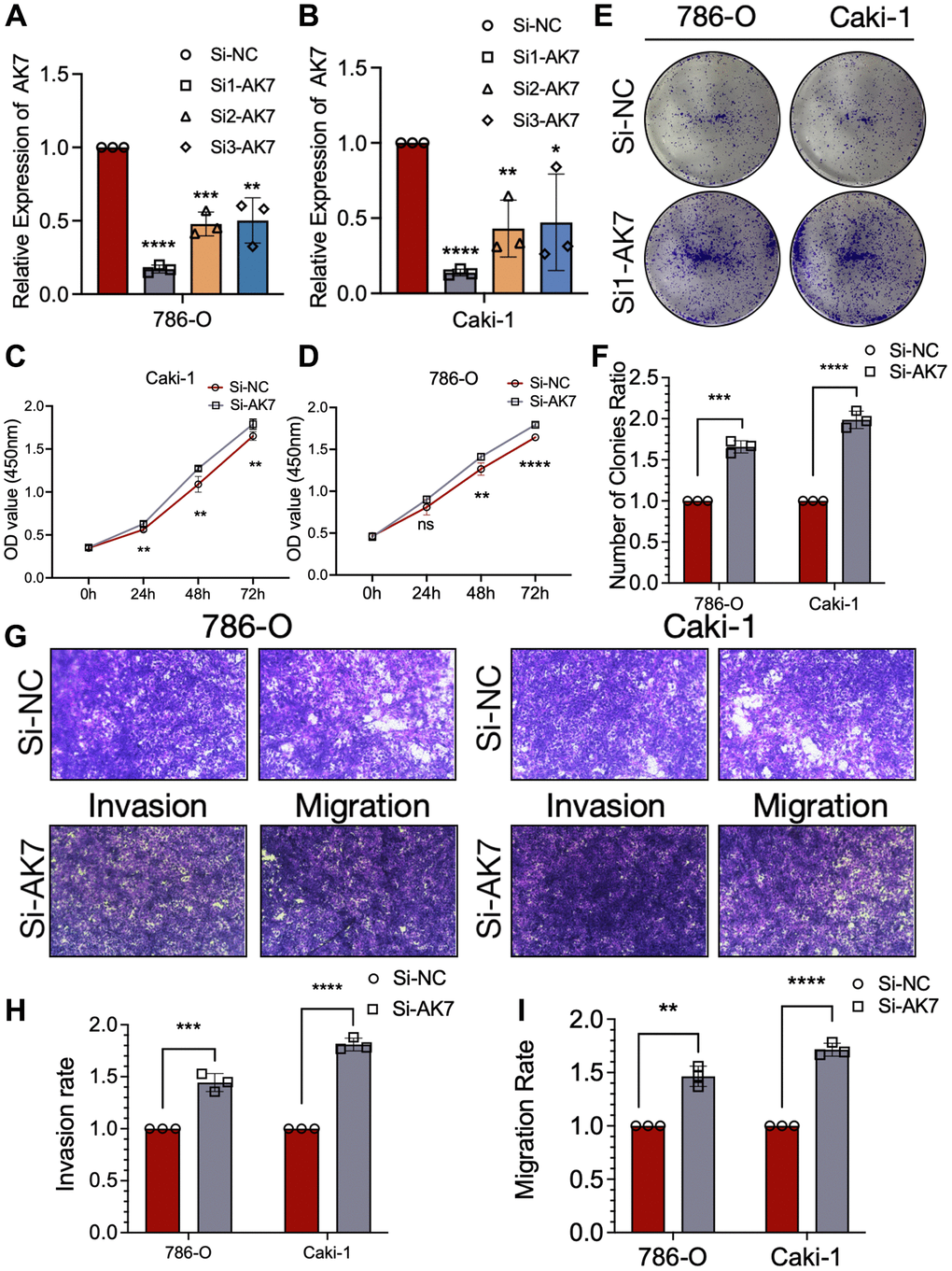 AK7 knockdown promoted the proliferation, invasion and migration ability of human ccRCC cell lines. (A, B) Three siRNAs (si1, si2, and si3) were designed to silence AK7 in ccRCC cells (786-O and Caki-1), and validated by qRT-PCR. (C, D) The growth curves of 786-O (C) and Caki-1 (D) cells were plotted after transfection with si1-AK7/si-NC based on CCK-8 assay. (E, F) Colony formation assays demonstrated that knockdown of AK7 promoted the proliferation of 786-O and Caki-1 cells. (G–I) Transwells experiment demonstrated that knockdown of AK7 expression could effectively promote the migration and invasion ability of ccRCC cells. *P **P ***P ****P 