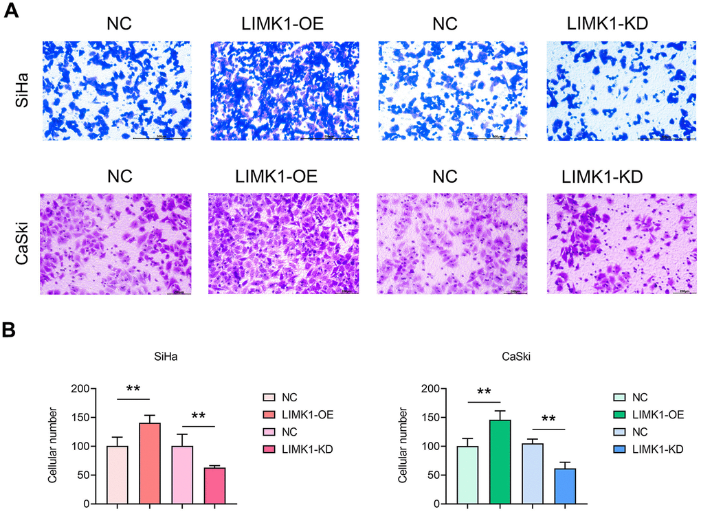 LIMK1 promoted the invasion of cervical cancer cells. (A) Representative images of SiHa and CaSki cells from Transwell infiltration experiments. (B) Statistical graph of the number of SiHa and CaSki cells infiltrated through the basement membrane. **P