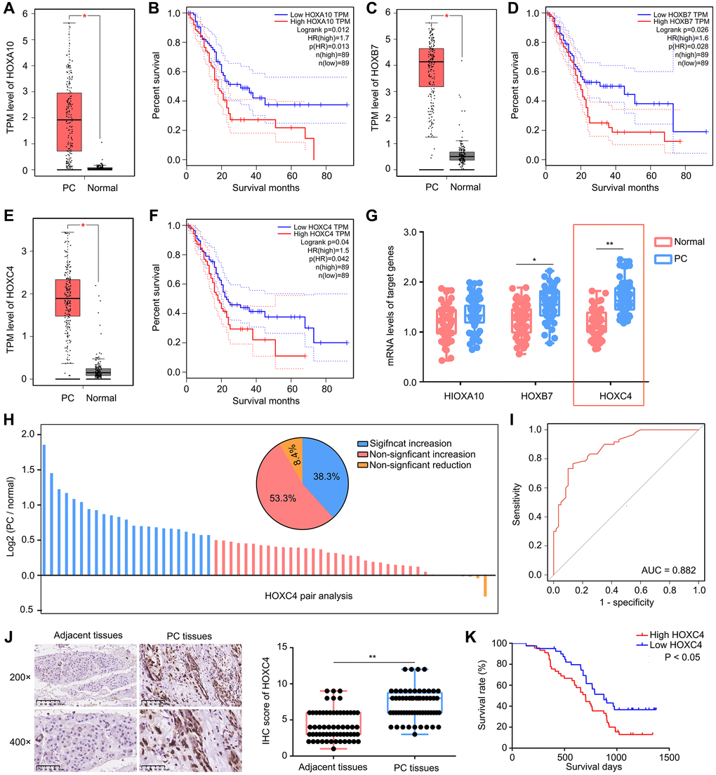 High expression of HOXC4 was observed in PC tissues and predicted poor outcome. (A, B) HOXA10 was highly expressed in PC tissues and associated with lower overall survival days. (C, D) HOXB7 was highly expressed in PC tissues and associated with lower overall survival days. (E, F) HOXC4 was highly expressed in PC tissues and associated with lower overall survival days. (G) qRT-PCR was used to detect the expression of HOXA10, HOXB7 and HOXC4 in PC tissues and adjacent tissues. (H) Pair analysis indicated that 53.5% PC patients had increased expression of HOXC4. (I) Diagnostic value of HOXC4 in PC. (J) IHC was used to detect the expression of HOXC4 in PC tissues and adjacent tissues. (K) KM plot indicated the survival days of PC patients with high and low HOXC4 expression. *P **P 