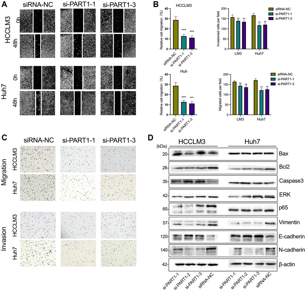 Downregulation of PART1 inhibits migration, invasion, and metastasis of HCC cells. (A) The migration and invasion were examined by wound healing assay in HCCLM3 and Huh7 cells transfected with siRNA-PART1.1 and -PART1.3. (B, C) The migration and invasion were illustrated by Transwell assay (40 × objective lens) in HCCLM3 and Huh7 cells transfected with siRNA-PART1.1 and -PART1.3. (D) The expression of apoptosis and EMT-related proteins (E-cadherin, vimentin, and N-cadherin) was detected by Western blotting. *p **p ***p 