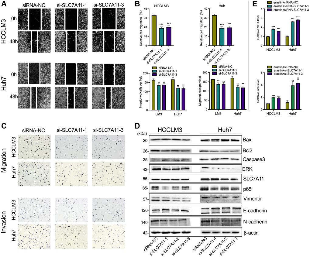 The knockdown of SLC7A11 inhibited motility and promoted apoptosis in HCC cells. (A–C) The migration and invasion were detected by Transwell assay (40 × objective lens) in HCCLM3 and Huh7 cells transfected with siRNA-SLC7A11.1 and -SLC7A11.3. The protein markers of the apoptosis were detected by Western blotting. (D) The expression of apoptosis and EMT-related proteins (E-cadherin, vimentin, and N-cadherin) was detected by Western blotting. (E) The relative levels of MDA and iron in HCCLM3 and Huh7 cells transfected with siRNA-SLC7A11.1 and -SLC7A11.3 in the erastin-induced ferroptosis assay. *p **p ***p 