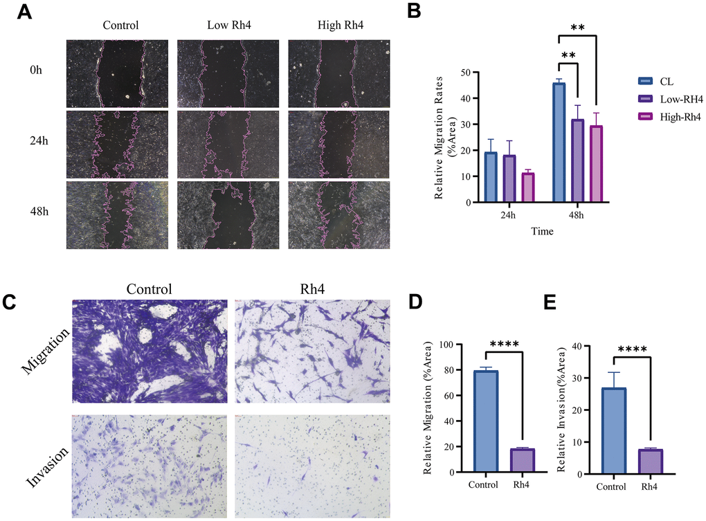 Impact of ginsenoside Rh4 on MG63/DXR cell migration and invasion. (A) Wound healing assay outcomes for MG63/DXR cells at 0-, 24-, and 48-hours post-treatment with control, low (20 μM), and high (40 μM) concentrations of Ginsenoside Rh4, depicting migration inhibition. (B) Quantitative analysis of the wound healing assay from panel A, indicating Ginsenoside Rh4’s effectiveness in reducing MG63/DXR cell migration. (C) Results from Transwell assays measuring MG63/DXR cell migration and invasion post-treatment with control and 40 μM ginsenoside Rh4 at 48h, revealing reduced migratory and invasive behaviors. (D) Quantitative assessment of migration from panel C, highlighting the inhibitory effect of ginsenoside Rh4 on cell migration. (E) Quantitative assessment of invasion from panel C, demonstrating ginsenoside Rh4’s ability to diminish cell invasion.