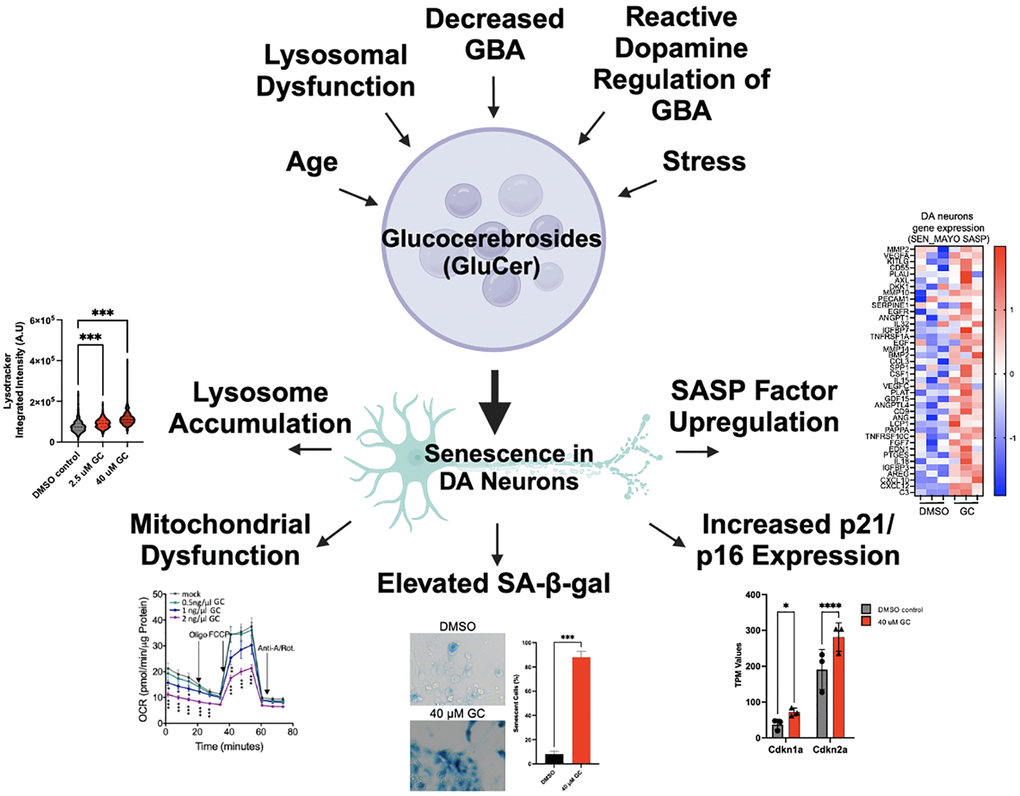 Overview of drivers of GluCer accumulation, which leads to cellular senescence in dopaminergic neurons. Aging, stress, lysosomal dysfunction, decreased levels of GBA, and the regulation of GBA by reactive dopamine have all been shown to lead to the accumulation of glucocerebrosides (GluCer). We have recently shown that the accumulation of GluCer directly drives senescence of dopaminergic (DA) neurons, indicated by lysosomal accumulation, mitochondrial dysfunction, elevated senescence-associated ß-galactosidase, increased p21/p16 expression, and SASP factor upregulation (representative diagrams and images are modified from our previous study [10]).