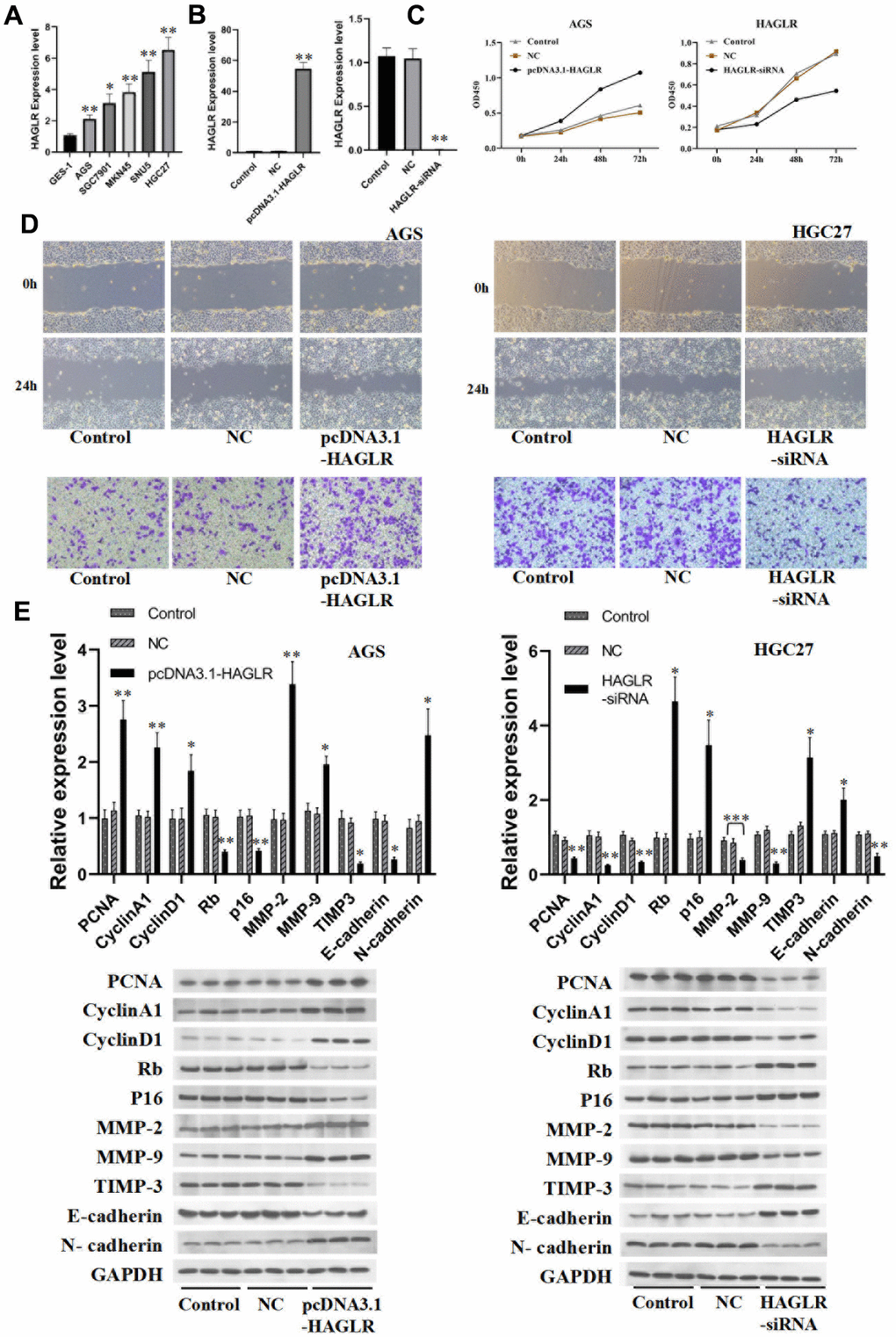 HAGLR induces the proliferation, migration, and invasion of GC cells. (A) The expression of HAGLR in various cell lines. (B) Knockdown or overexpressed HAGLR in AGS cell line. (C) The effects of differentially expressed HAGLR on cell proliferation were confirmed by CCK-8 assay. (D) Scratch wound healing and Transwell assays revealed the migration and invasion ability of GC cells transfected HAGLR-siRNA or pcDNA3.1-HAGLR. (E) Western blotting assay indicated the level of proteins with HAGLR knockdown or overexpression. (*P 