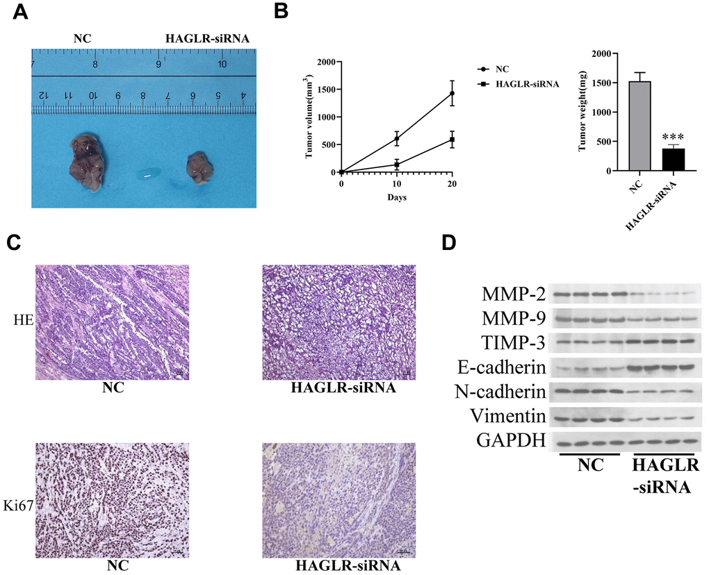 HAGLR facilitates the tumor progression in vivo. (A) Diagram of tumor-bearing experimental results in nude mice. (B) Tumor volume and weight changes in the 2 groups. (C) IHC analysis of the Ki-67 level. (D) Western blotting assay showed the levels of related proteins. (*P 