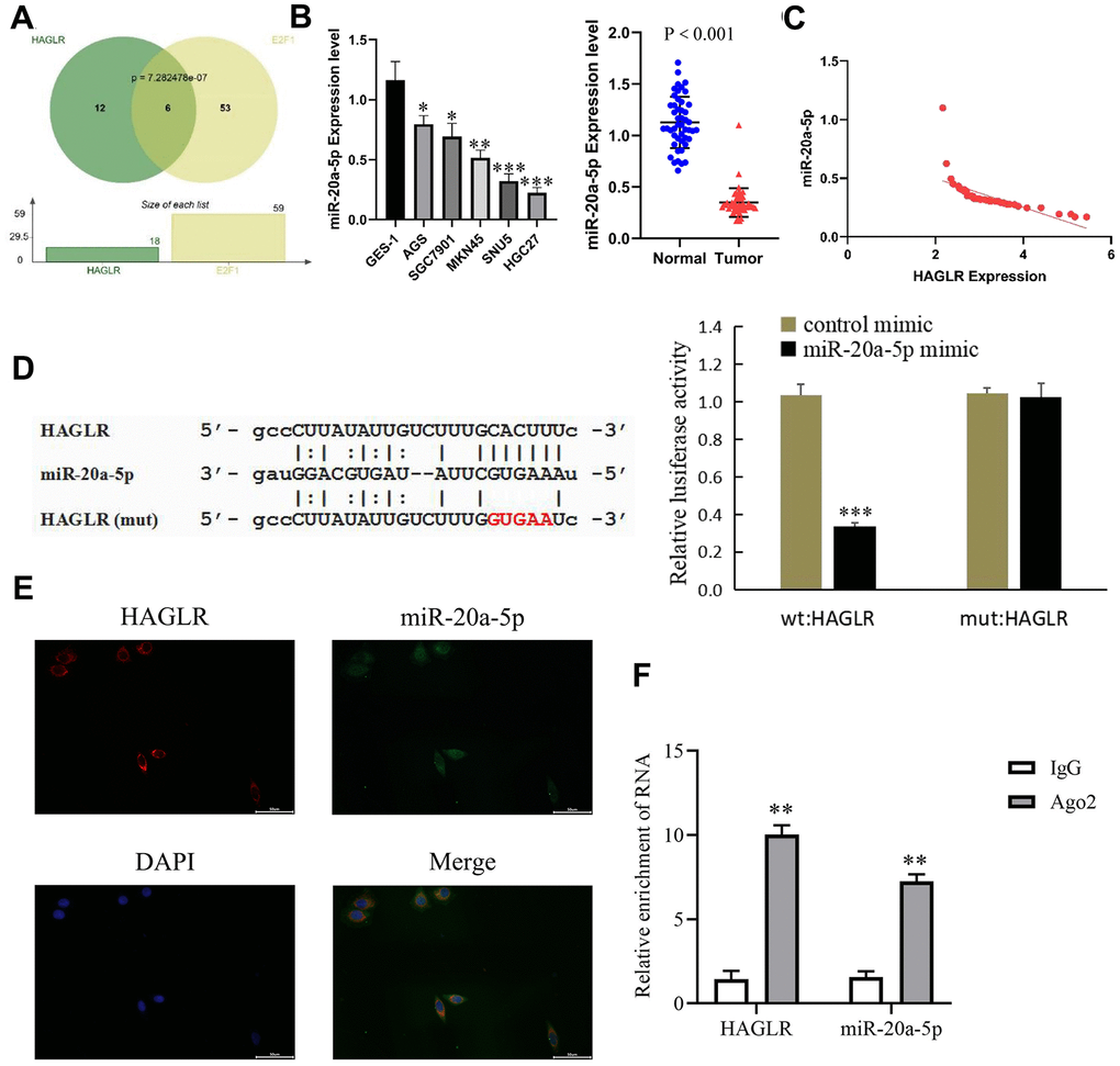 HAGLR binds to miR-20a-5p. (A) Hypergeometric test of HAGLR and the target miRNAs of E2F1. (B) The expression of miR-20a-5p in GC tissues and cells. (C) Correlations of the expression of HAGLR and miR-20a-5p. (D) Dual luciferase assay showed that HAGLR downregulated miR-20a-5p. (E) Fluorescence in situ hybridization results. (F) Diagram of RIP experimental results. (*P 